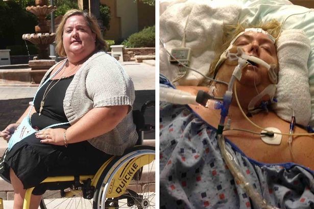 Alami Infeksi Usai Terpeleset, Victoria Harus Kehilangan Kedua Kakinya