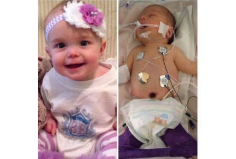 Duh, Kandung Kemih Bayi asal Texas Ini Terurai di Luar Tubuhnya