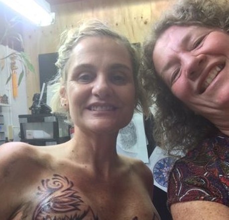 Ditutup Tato Bunga, Bekas Mastektomi di Payudara Alyson Tak Tampak Lagi