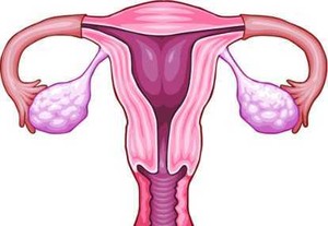 Marak Bisnis Prostitusi, Dokter Ingatkan Risiko Kanker Serviks