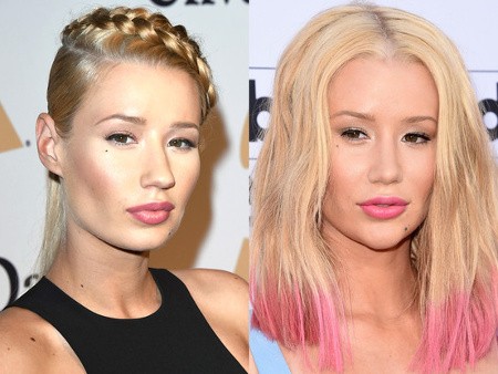 Iggy Azalea Diduga Operasi Hidung dan Dagu