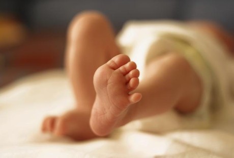 Kasus Langka, Dua dari Bayi Kembar Tiga Ini Mengalami Dempet Panggul