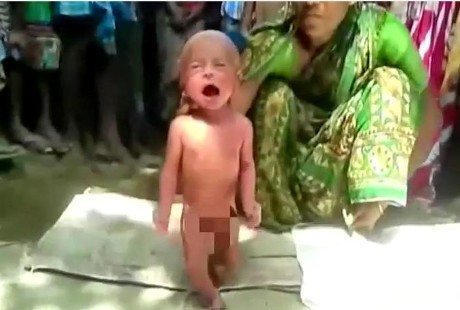Astaga! Bayi Dua Hari Dipaksa Berjalan oleh Dukun Agar Panasnya Turun