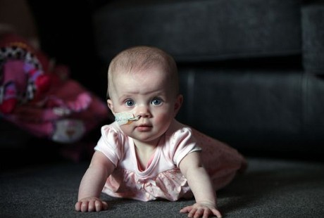 Imunitas Sangat Lemah, Flu Saja Bisa Berakibat Fatal Bagi Bayi 8 Bulan Ini