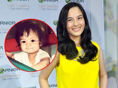 Sekarang Cantik, Begini Wajah Cute Chelsea Islan Saat Kecil