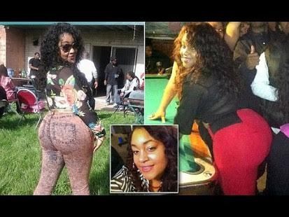 Wanita Ini Meninggal, Diduga karena Suntik Silikon Ilegal di Bokong