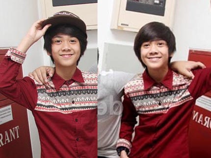 Iqbaal CJR Kecelakaan Motor Usai Salat Subuh, Tulang Patah