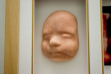 Foto Hitam Putih USG Siap Digeser oleh Suvenir Wajah Timbul Janin