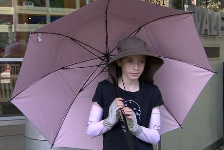 Mirip Alergi Matahari, Savannah Terbakar Jika Berada di Luar Rumah