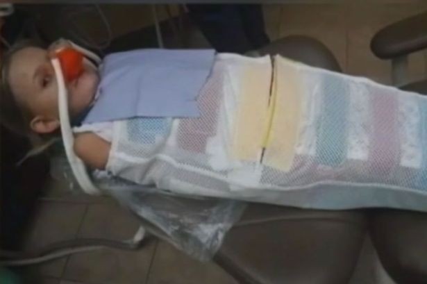 Tak Bisa Tenang Saat Periksa Gigi, Bocah Ini Dimasukkan ke Kantong Mayat