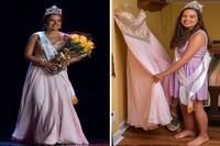 Bahkan bulan lalu, gadis yang masih berumur 19 tahun itu memenangkan sebuah kontes kecantikan yang diselenggarakan di kota kelahirannya, Campbellton, New Brunswick, Kanada. Ia tetap percaya diri meski diminta memakai bikini atau gaun cantik untuk pemotretan. Ia berharap kemenangannya itu akan meningkatkan kesadaran masyarakat tentang kondisinya. (Foto: Barcroft/Daily Mail)