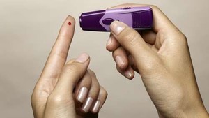 Studi: Minyak Kedelai Tingkatkan Risiko Obesitas dan Diabetes Tipe 2