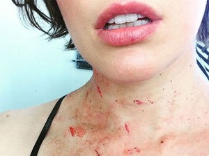Jejak Berdarah di Leher Alice sang Pembasmi Zombie