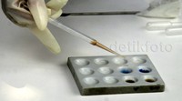 Petugas melakukan uji laboratorium.