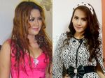 Begini Wajah Baru Nita Talia Pasca Operasi Plastik