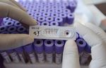 Antisipasi Dini Penyebaran HIV AIDS