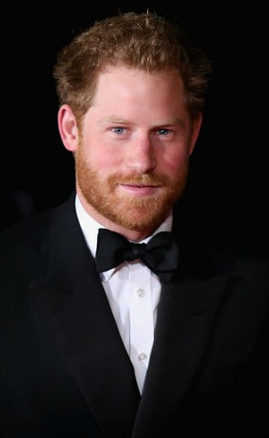 Masih Muda, Pangeran Harry Mengalami Kebotakan Seperti Kakak dan Ayahnya