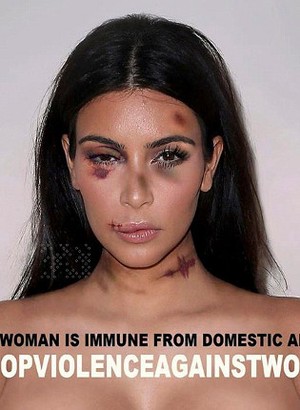 Saat Kim K Hingga Angelina Jolie Babak Belur untuk Kampanye Anti Kekerasan