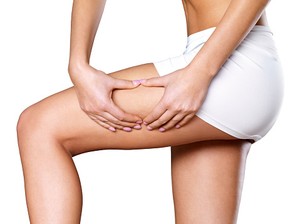 Hindari Konsumsi Gula dan Makanan Asin untuk Cegah Selulit