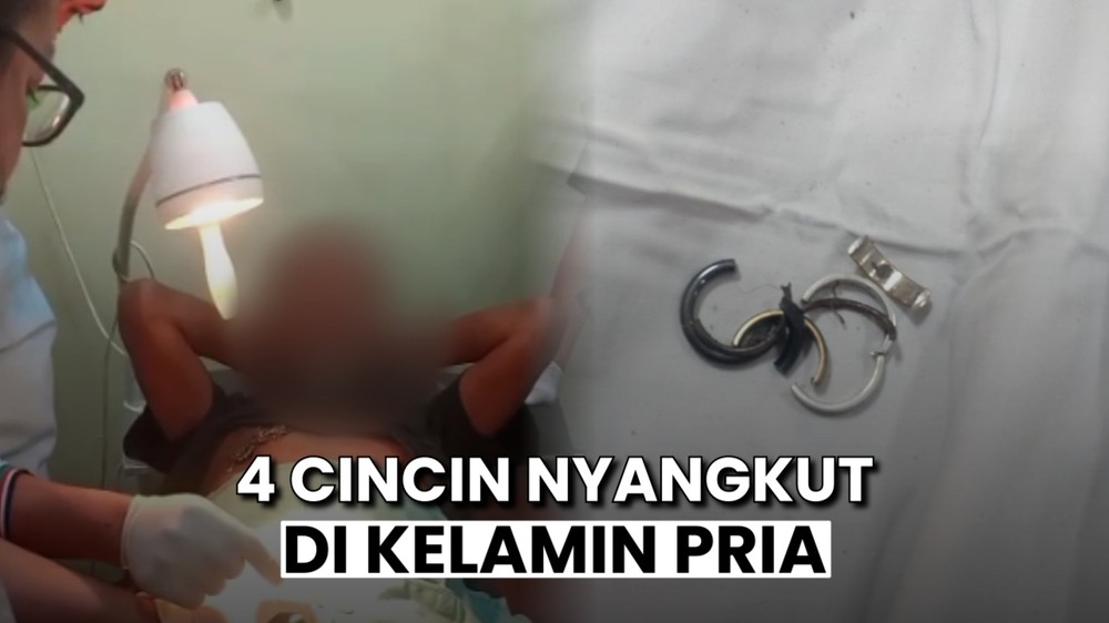 Evakuasi Cincin di Kelamin