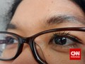 Semua Orang Berhak Dapat Akses Perawatan Mata yang Baik