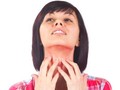 Pasien Psoriasis Tetap Bisa Hidup Normal