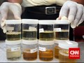 Hasil Tes Urine Seorang Kapolres di Sumsel Positif Narkotika