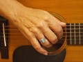 Pria India Jalani Operasi Otak 7 Jam Sambil Main Gitar