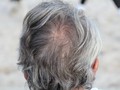 Penyebab Rambut Memutih di Usia Muda