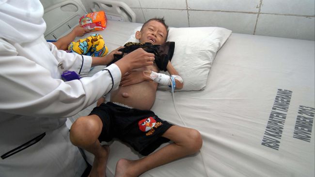 Gizi Buruk Ancam Semua Lapisan Masyarakat