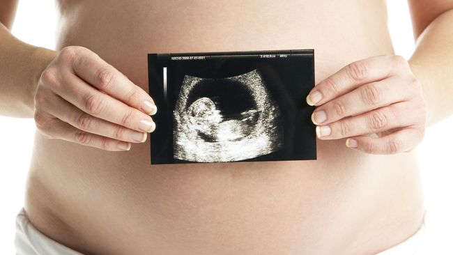 Dokter Membalik Posisi Bayi Sungsang dengan Kedua Tangan