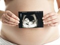 Polusi Udara Bikin Bayi Lahir dengan Kurang Berat Badan