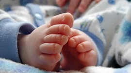 Mengenal Cyclopia, Kondisi yang Dialami Bayi Bermata Satu