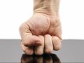 Kehilangan Penis, Pria Essex Tuntut Rumah Sakit