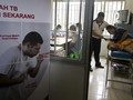 Minim Penelitian, TBC Diprediksi Baru 'Musnah' 2045 Mendatang