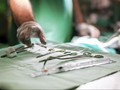 Transplantasi Kepala Manusia Hampir Jadi Kenyataan