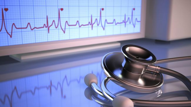 Cara Unik Mengenal Gejala-gejala Stroke dengan Cepat