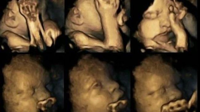 Janin dari Ibu Perokok Menutup Wajah di Rahim