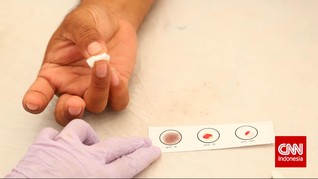 AS Longgarkan Aturan Donor Bagi Gay karena Virus Corona