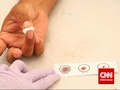 AS Longgarkan Aturan Donor Bagi Gay karena Virus Corona
