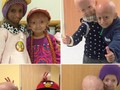 Hayley Okines, Remaja Bertubuh Nenek-nenek Usia 100 Tahun