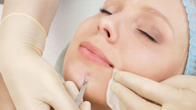 Lima Hal yang Perlu Diketahui Tentang Facial