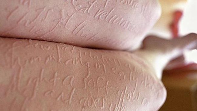 Penyakit Boleh Langka, Tapi Tidak dengan Harapan