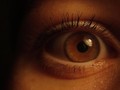 Yang Harus Diperhatikan Sebelum Operasi Lasik