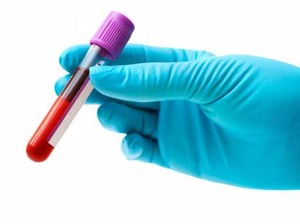 PMI Bakal Kerja Sama dengan Korea Selatan Produksi 200 Ribu Liter Plasma