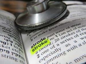 RTPA, Upaya Indonesia Cegah Kematian dan Kurangi Kecacatan Akibat Stroke