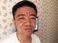 Pria 30 Tahun Berwajah Kakek-kakek karena Penyakit Misterius