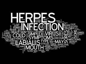 Mengenal Herpes Labialis: Penyebab, Gejala, dan Pengobatannya