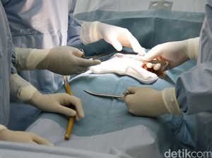 Kakak Adik Jadi Dokter Bedah padahal Cuma Lulusan SMA, Pasiennya Tewas