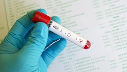 Kemenkes RI Pastikan Lonjakan Kasus HIV di Sidoarjo Bukan Karena Penularan Meningkat
